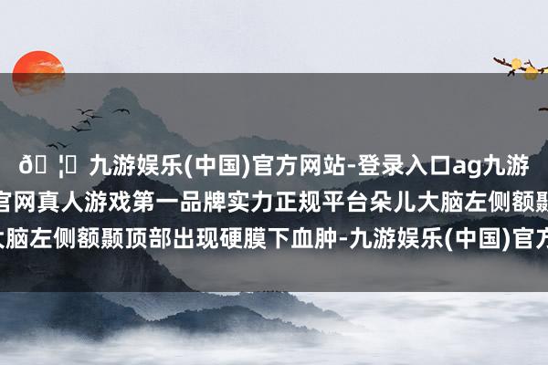 🦄九游娱乐(中国)官方网站-登录入口ag九游会官方⚽ag九游会官网真人游戏第一品牌实力正规平台朵儿大脑左侧额颞顶部出现硬膜下血肿-九游娱乐(中国)官方网站-登录入口